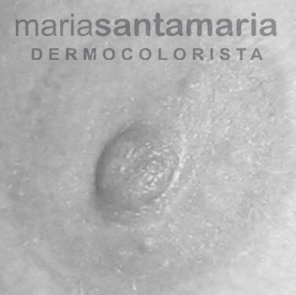 MIcropigmentación de areola