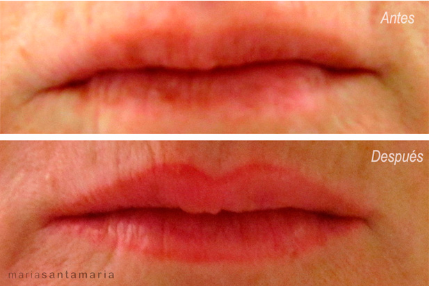 Labios